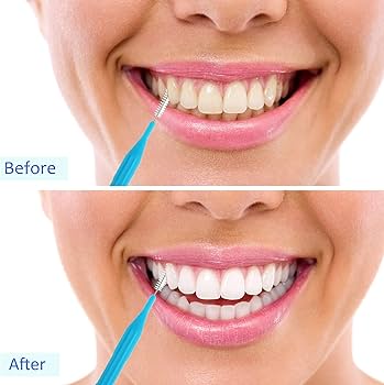 Pre-Teen Interdental Picks (50 Pack)